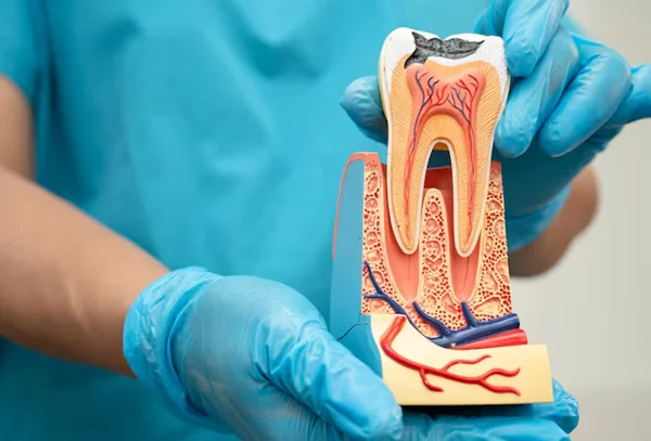 Root Canal Treatment