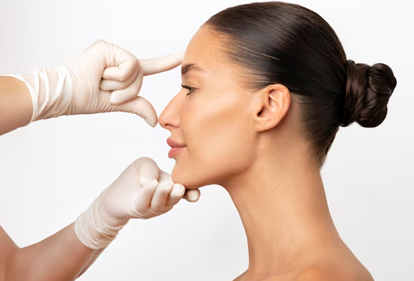 Rhinoplasty